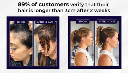 🌿 HZA™ Natural Hair Regrowth Spray – 70% OFF Ends Tonight!